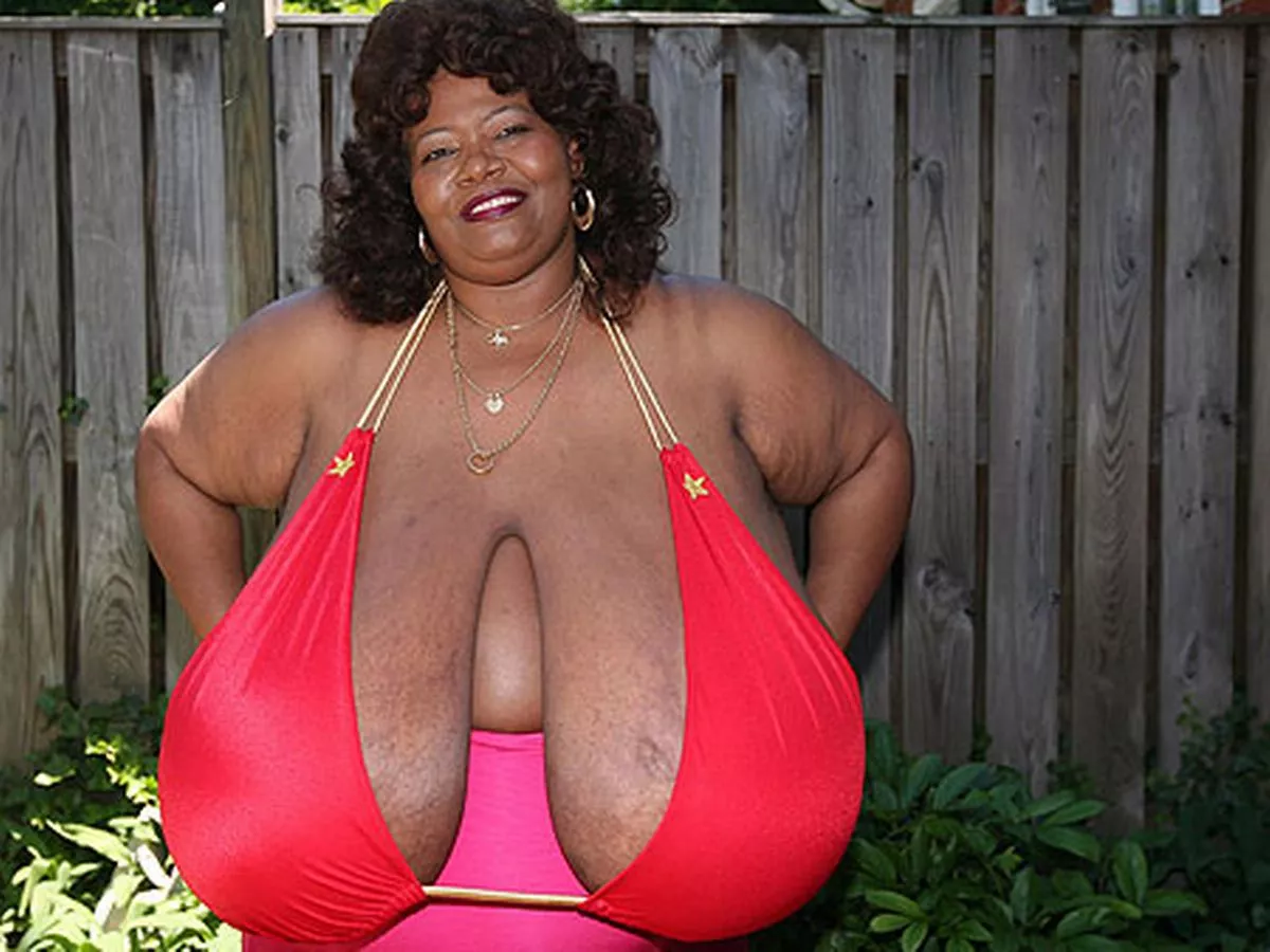 Meet the woman with the biggest breasts in the world.. Norma Stitz no kidding