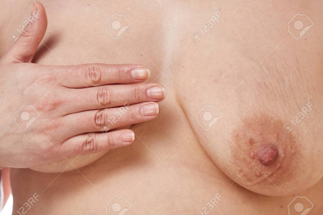 A 40-year-old Overweight Woman Shows Off Her Naked Saggy Breasts Against A White Isolated Background. Concept For Medicine And Cosmetology Stock Photo Picture and Royalty Free Image. Image 146104275.