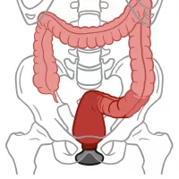 An In-Depth Guide to Anal Training Stretching Gaping