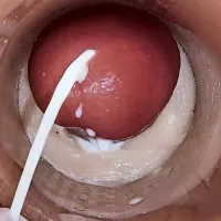 Camera Inside Deep Pussy Captures Huge Ejaculation of Sperm: Amateur Amateur Porn