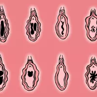 The Vaginal Corona the Hymen Virginity Myths