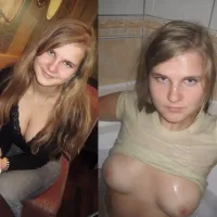Dressed Undressed Teen Girl Amateur : rDressedAndUndressed