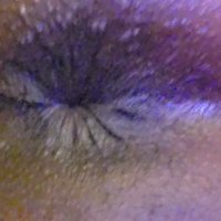 Anal cam