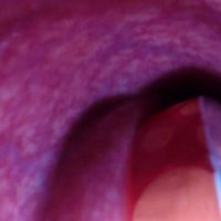 Internal Camera Deep Can Insertion