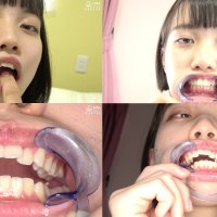 Tooth and oral cavity New actress Yukino Eru-chan39s finger blow job and rare tooth and oral cavity observation play!: ADOA: ToothMouth : XCREAM