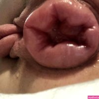 Pumped asshole and pussy. Strangest feeling ever!!! The swelling got down and I was normal