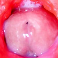 Camera Inside Anal Almost Cum in Ass Best Internal Asmr in 4k: Gay Porn