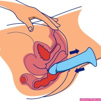 Anal Dildos: Everything You Need To Know