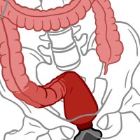 An In-Depth Guide to Anal Training Stretching Gaping